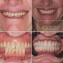 Dr. Carlos Scherer | Cirurgião Dentista Passo Fundo
