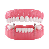 Dr. Carlos Scherer | Cirurgião Dentista Passo Fundo