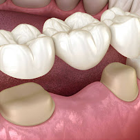 Dr. Carlos Scherer | Cirurgião Dentista Passo Fundo