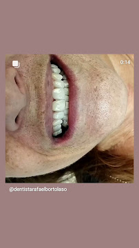 Rafael Bortolaso