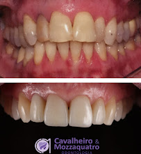 Cavalheiro e Mozzaquatro Odontologia - Implantes e Ortodontia