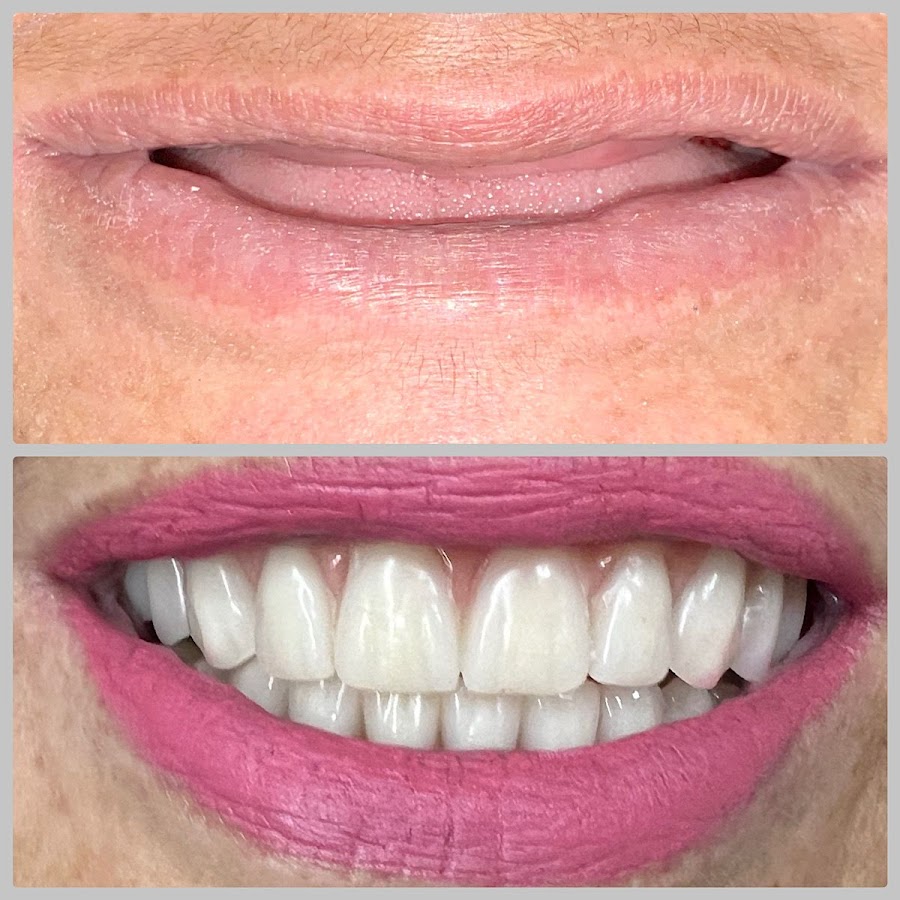 Saúde Center Odontologia | Implante dentário | Dentista | Implantes | Unidade Delfino Magalhães - dental clinic in Montes Claros