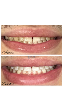 Saúde Center Odontologia | Implante dentário | Dentista | Implantes | Unidade Delfino Magalhães
