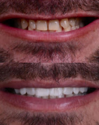 Saúde Center Odontologia | Implante dentário | Dentista | Implantes | Unidade Delfino Magalhães