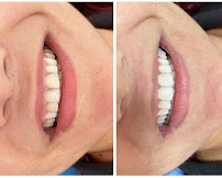Saúde Center Odontologia | Implante dentário | Dentista | Implantes | Unidade Delfino Magalhães