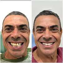 Saúde Center Odontologia | Implante dentário | Dentista | Implantes | Unidade Delfino Magalhães