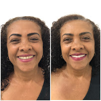 Saúde Center Odontologia | Implante dentário | Dentista | Implantes | Unidade Delfino Magalhães