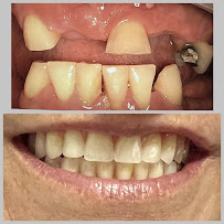 Saúde Center Odontologia | Implante dentário | Dentista | Implantes | Unidade Delfino Magalhães