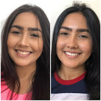 Saúde Center Odontologia | Implante dentário | Dentista | Implantes | Unidade Delfino Magalhães