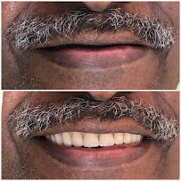 Saúde Center Odontologia | Implante dentário | Dentista | Implantes | Unidade Delfino Magalhães