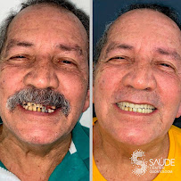 Saúde Center Odontologia | Implante dentário | Dentista | Implantes | Unidade Delfino Magalhães