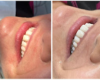 Saúde Center Odontologia | Implante dentário | Dentista | Implantes | Unidade Delfino Magalhães
