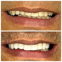 Saúde Center Odontologia | Implante dentário | Dentista | Implantes | Unidade Delfino Magalhães