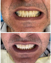 Saúde Center Odontologia | Implante dentário | Dentista | Implantes | Unidade Delfino Magalhães