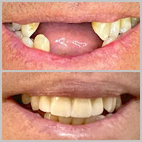 Saúde Center Odontologia | Implante dentário | Dentista | Implantes | Unidade Delfino Magalhães
