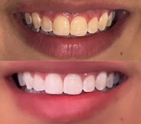 Saúde Center Odontologia | Implante dentário | Dentista | Implantes | Unidade Delfino Magalhães