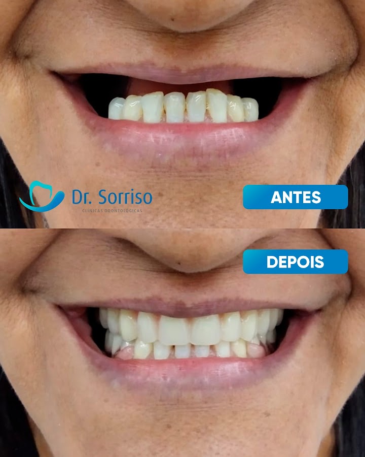 Dr. Sorriso | Dentista em Montes Claros - dental clinic in Montes Claros, Brazil