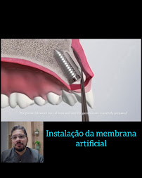 Obno Odontologia - Implantes Dentários em Montes Claros