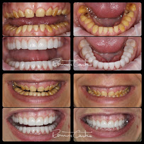 Obno Odontologia - Implantes Dentários em Montes Claros