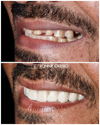Obno Odontologia - Implantes Dentários em Montes Claros
