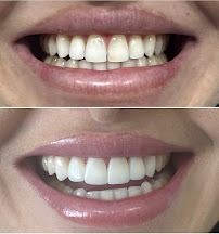Aguilar Odonto Implantes, Implante Dentário Montes Claros