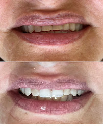 Aguilar Odonto Implantes, Implante Dentário Montes Claros