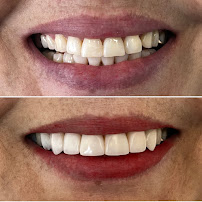 Aguilar Odonto Implantes, Implante Dentário Montes Claros