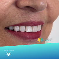 Aguilar Odonto Implantes, Implante Dentário Montes Claros