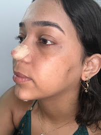 Instituto Dr. Victor Santos - Harmonização e Cirurgia Facial