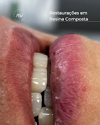 MW Odontologia – Clínica Odontológica em Pelotas