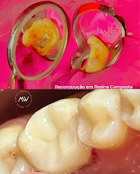 MW Odontologia – Clínica Odontológica em Pelotas