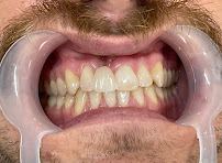 Lotus Smile Dental - Nha khoa Quốc tế Đà Nẵng