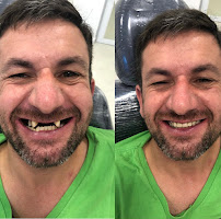 LM Odontologia Reabilitadora - Clínica Odontológica