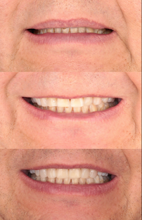 Dra. Aide Montserrat Orozco Gutierrez, Dentista - Odontólogo