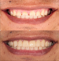 Dra. Aide Montserrat Orozco Gutierrez, Dentista - Odontólogo