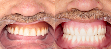 Dra. Aide Montserrat Orozco Gutierrez, Dentista - Odontólogo