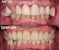 Dra. Aide Montserrat Orozco Gutierrez, Dentista - Odontólogo