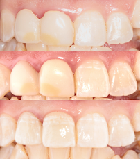 Dra. Aide Montserrat Orozco Gutierrez, Dentista - Odontólogo