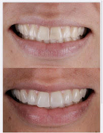 TATSCH Odontologia