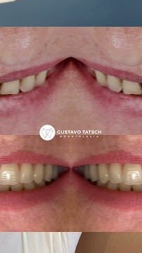 TATSCH Odontologia