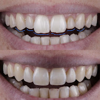 TATSCH Odontologia