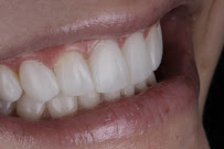 TATSCH Odontologia