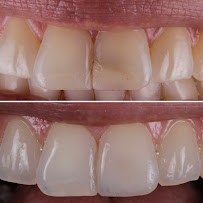 TATSCH Odontologia