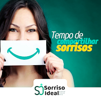 Sorriso Ideal