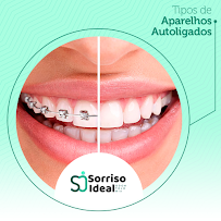 Sorriso Ideal