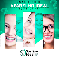 Sorriso Ideal