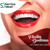 Sorriso Ideal