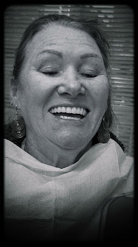 Sin Oral Implants