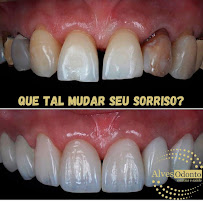 Alves Odonto