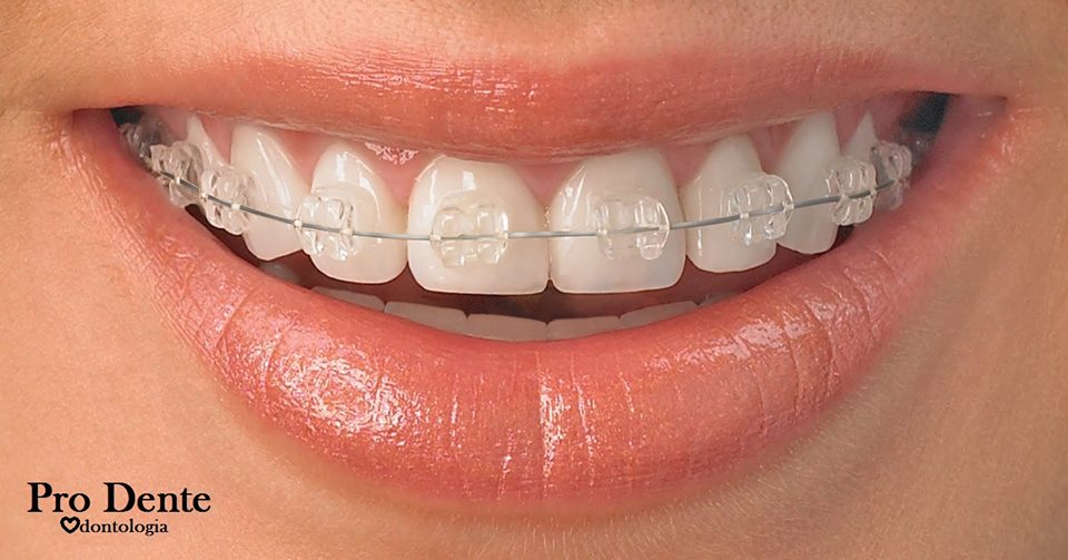 Dental Clinic Dentistas Piracicaba Pro Dente dental clinic in Piracicaba